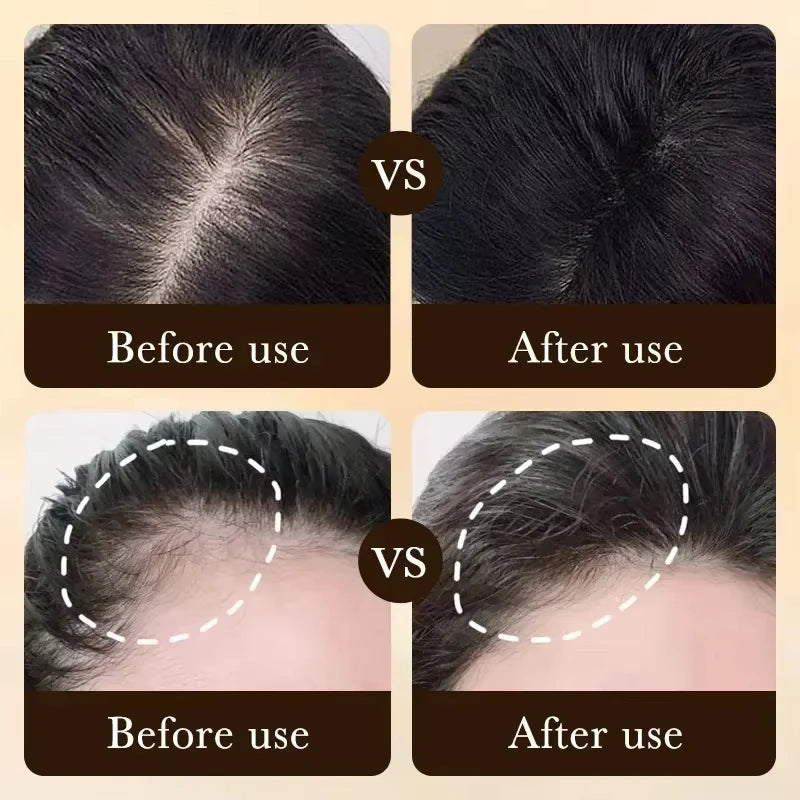 Hair Growth Treatment Strengthens Hair Nourishes Scalp Light Weight Non Greasy Improve Scalp Circulation